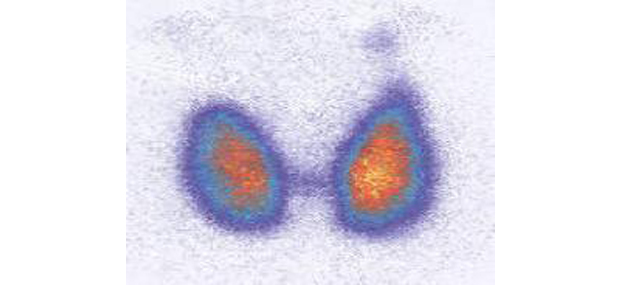 Thyroid diagram.